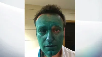Aleksei Navalnîi a fost operat la ochi, în Spania