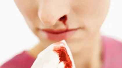 De ce curge sânge din nas