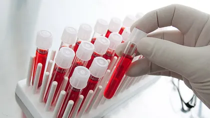 O analiză de sânge poate detecta cancerul ovarian