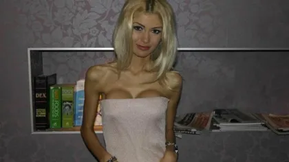 Cum arată acum cea mai cunoscută anorexică din România GALERIE FOTO