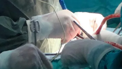 Accident de muncă la Suceava: Un chirurg ortoped şi-a rupt un picior chiar în faţa sălii de operaţie