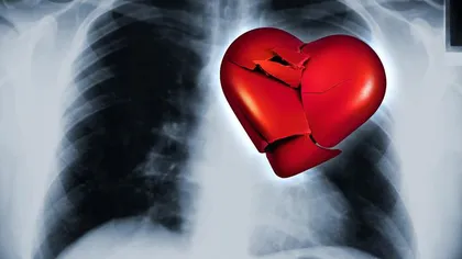 Ce este sindromul inimii frânte: O femeie a primit diagnosticul după ce i-a murit câinele