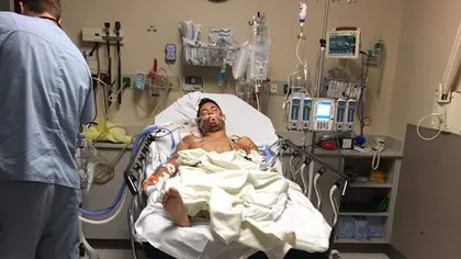 Românul rănit în atacul din Las Vegas mai rămâne o zi conectat la aparate