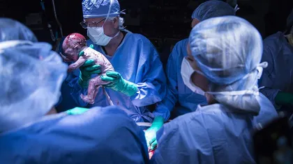 Miracol în SUA: O femeie cu uter transplantat a născut un copil sănătos. Este o premieră medicală în Statele Unite