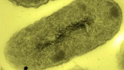 Bacteria care detectează şi transformă aurul în pepită