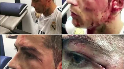 Imagini şocante cu Cristiano Ronaldo, a fost desfigurat cu crampoanele VIDEO