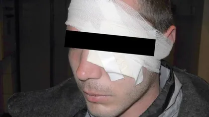 Tânăr bătut într-un bar din Cluj. Iubita acestuia a asistat la întreaga scenă
