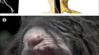 Omul de Cro-Magnon avea chipul acoperit de noduli