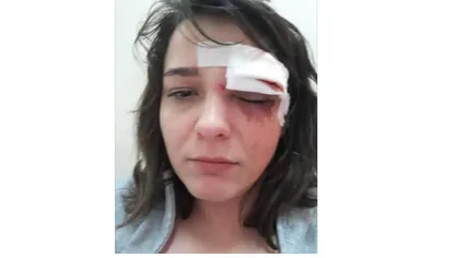 Caz şocant în Bucureşti: O tânără povesteşte pe Facebook cum a fost atacată şi jefuită pe stradă