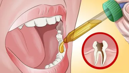 Dureri de dinţi. Ce sa faci când te doare măseaua. Cele mai bune remedii naturale
