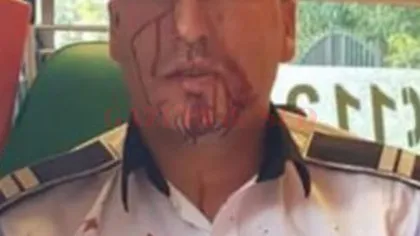 Poliţist din Craiova, agresat când a încercat să imobilizeze un şofer care a refuzat să oprească la semnale. S-au tras focuri de armă