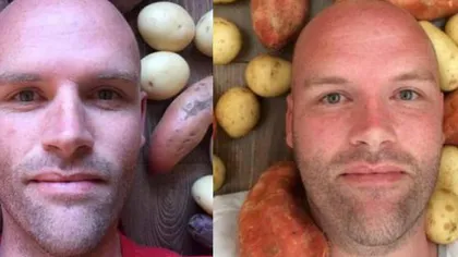 Bărbatul ăsta a mâncat doar cartofi timp de un an. Uite ce i s-a întâmplat FOTO