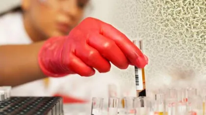 Testul care detectează prezența celulelor canceroase în doar 10 minute. Totul este posibil cu ajutorul unui metal prețios