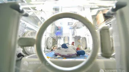O femeie cu uter dublu a născut gemeni, la aproape o lună după ce adusese prematur pe lume un băieţel