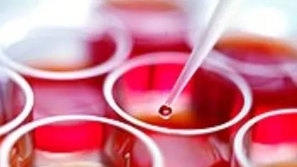 Medici şi reprezentanţi ai pacienţilor, apel pentru donarea de celule stem hematopoietice