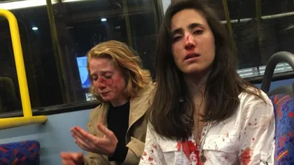 Două tinere au fost bătute şi umilite într-un autobuz pentru că nu au vrut să se sărute. Cum s-a terminat totul