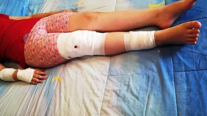O fetiţă de 10 ani a fost sfâşiată de un maidanez. Micuţa îi dăduse restul de sandwich rămas de la şcoală FOTO