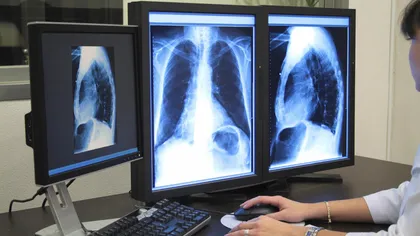 Un medic din Botoşani s-a îngrozit după ce i-a făcut o radiografie unui pacient