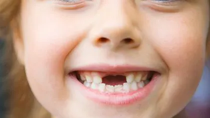 De ce nu este bine să aruncăm dinţii de lapte ai copiilor. Sigur îi vei păstra după ce vei citi asta