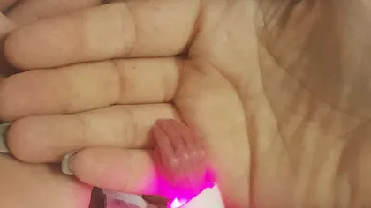 Născută la 24 de săptămâni, cu mâna cât o monedă! Cum arată Isabella, după ce a primit 5% şanse de viaţă