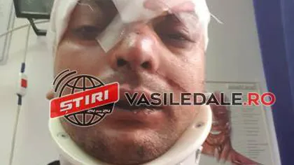 Imagini şocante într-un club din România! Tânăr bătut şi aruncat în cap pe scări de către paznic VIDEO