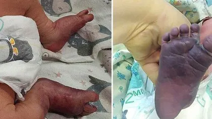 Chinurile prin care a trecut un bebeluş! Două moaşe necalificate i-au RUPT PICIOARELE în timpul naşterii