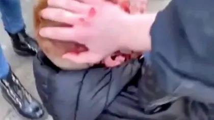 Imagini şocante! Un copil a fost bătut cu bestialitate de un poliţist. I-a spart capul cu bastonul - FOTO