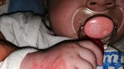 Caz cumplit la Hunedoara! O fetiţă de 5 luni s-a ales cu răni grave după ce a fost internată la spital pentru o răceală