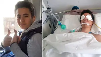 A murit Andrei Ivan, băiatul de 14 ani din Mangalia, bătut cu bestialitate pe stradă în luna februarie