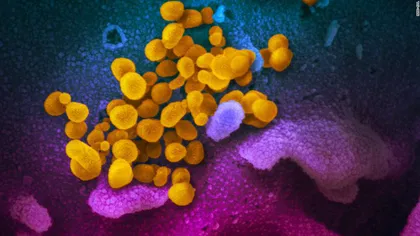 Cum luptă corpul nostru împotriva coronavirusului? Cercetătorii au captat reacţia sitemului imunitar la infecţia cu Covid-19