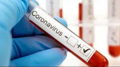 Ministerul Sănătăţii, anunţ de ultimă oră despre pericolul de a rămâne fără teste de diagnosticare a coronavirusului