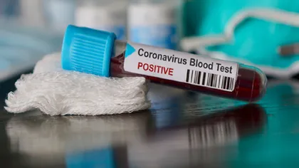 Experţii epidemiologi au veşti proaste despre cum va influenţa căldura evoluţia epidemiei de coronavirus