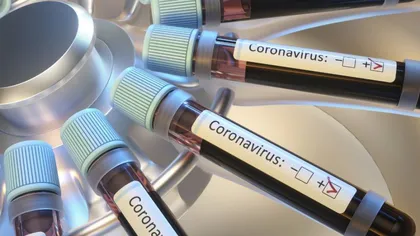Încă 100 de pacienţi de la spitalul din Suceava aşteaptă rezultatul testării pentru coronavirus. 