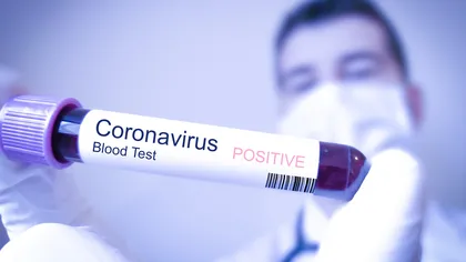 Primăria Deva s-a închis din cauza coronavirusului. Primarul, fiica lui şi administratorul public sunt infectaţi cu COVID-19