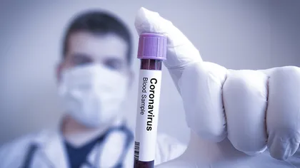 Un medic de 31 de ani din Timisoara, confirmat cu coronavirus: A dezvoltat febra si tuse