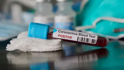 Coronavirus în Marea Britanie - Alte 684 de decese; aproape 20.000 de victime în total