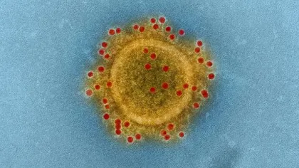 COVID-19. Un sfert dintre cei infectaţi în focarul epidemiei din Franţa au dezvoltat deja anticorpi împotriva virusului