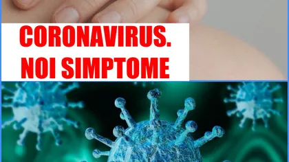 S-a descoperit un simptom mai putin cunoscut al coronavirusului. Ce au observat medicii la buzele multora dintre cei infectaţi