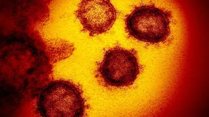 Institutul Cantacuzino are informaţii despre tipul de coronavirus care circulă în România. Este diferit faţă de tulpina de la Wuhan