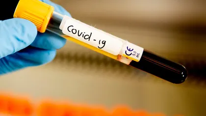 Bani pentru oamenii din Bucureşti care se oferă să fie testaţi pentru coronavirus. Ce implică proiectul Primăriei Capitalei