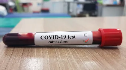 CIFRE ALARMANTE! La fiecare 18 secunde, un om moare din cauza coronavirusului