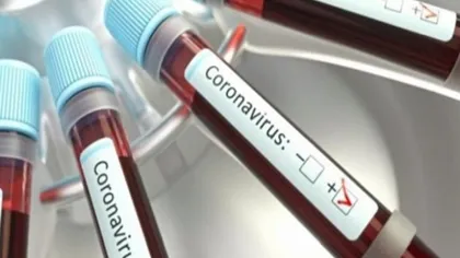 Coronavirus în România. 166 de cazuri noi de infectare şi 17 decese, în ultimele 24 de ore