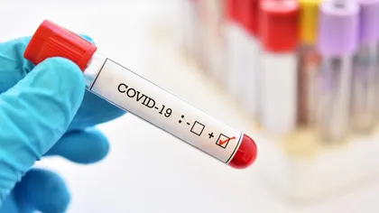 COVID-19. Numărul infecţiilor cu coronavirus în creştere în România. Autorităţile anunţă 189 de cazuri noi