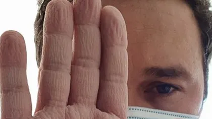 Fotografia zilei: Cum arată mâna unui chirurg, care a stat 4 ore în operaţie la 28 de grade ca să salveze o viaţă