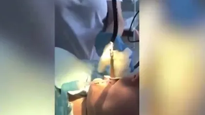 Imagini care te vor face să tresari! O femeie a ajuns la spital după ce un şarpe i-a intrat în gât