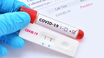 Primul test rapid de depistare a virusului SARS COV 2 produs în România. Funcţionează similar cu un test de sarcină
