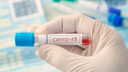 Nicuşor Dan o copiază pe Firea: Contacţii persoanelor infectate cu coronavirus, testate de COVID pe banii Primăriei Capitalei