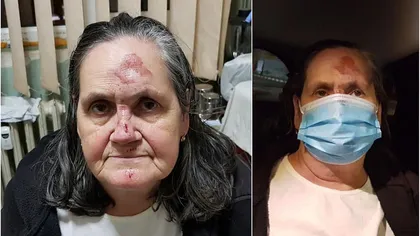 Bătrână infectată cu coronavirus, prăbuşită şi lovită la cap în faţa Spitalului Universitar din Bucureşti: 