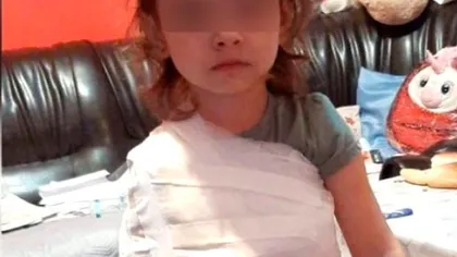 Medic la spitalul din Corabia a bandajat mâna unei copile cu tot cu tricou. Managerul subliniază că procedura a fost corectă. Măsura luată de DSP