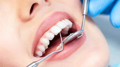 Când e necesar un implant dentar și ce avantaje are față de alte tipuri de tratament